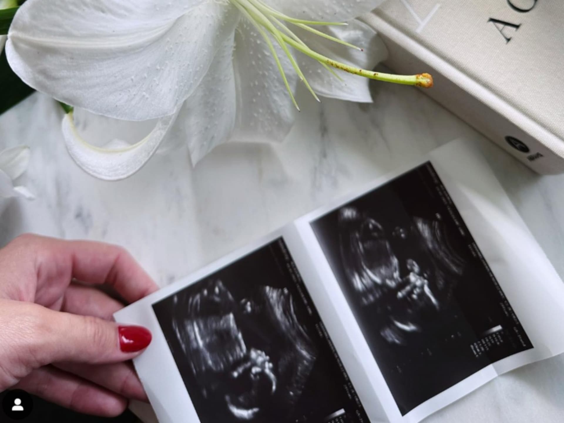 Josh Duhamel: Erstes Baby mit seiner Frau Audra