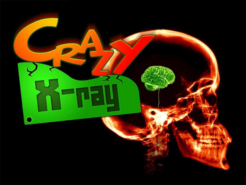 Crazy Xray