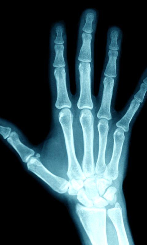 Mega Xray Scanner