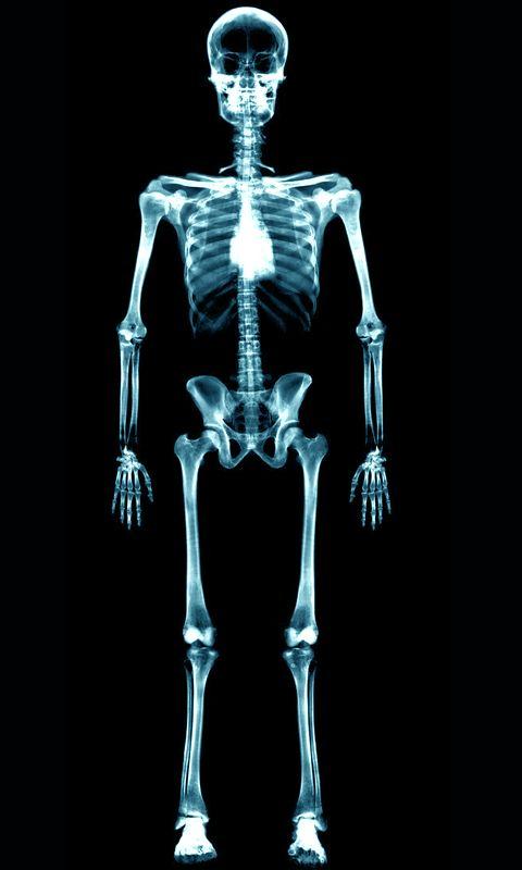 Mega Xray Scanner